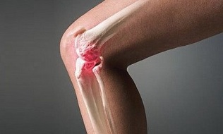 jak se artritida liší od artrózy