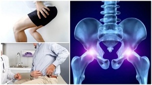 klasifikace osteochondrózy páteře