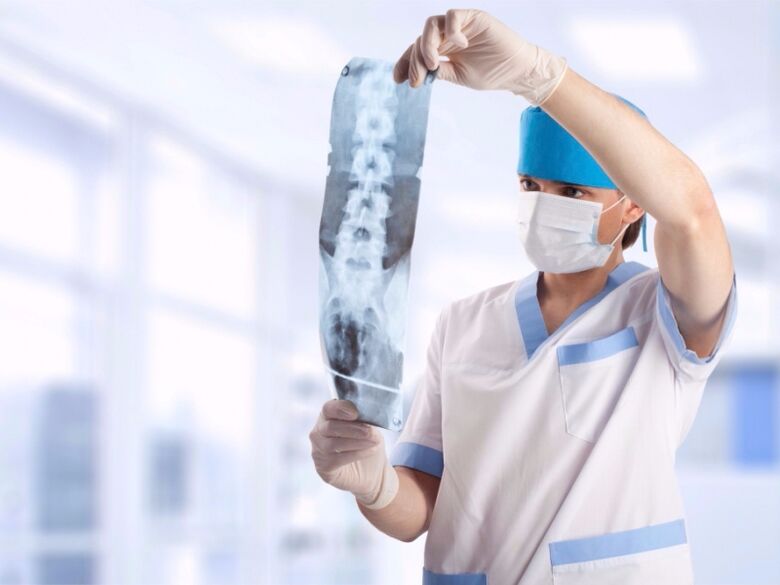 doktor se dívá na snímek krční páteře s osteochondrózou
