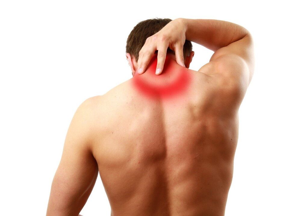 Cervikální osteochondróza je důsledkem přepětí a oslabení elasticity svalů v oblasti krku