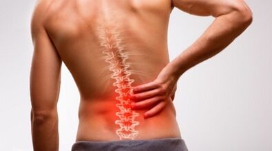 Příznaky a příznaky osteochondrosy bederní páteře